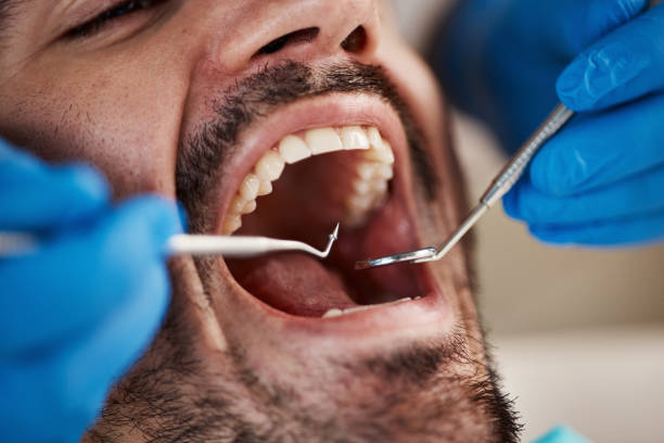 Best Broken Tooth Emergency  in Mariemont, OH